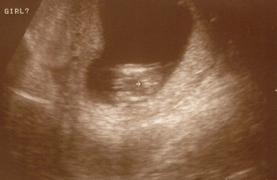 Update! New 16 week Potty shots pg 1! Please confirm! *Nub Video Pg 2