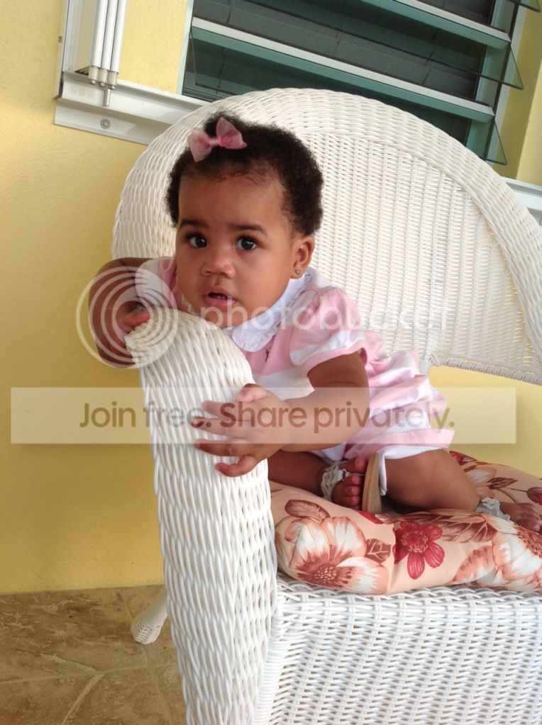 Baby's skin color Page 4 BabyCenter